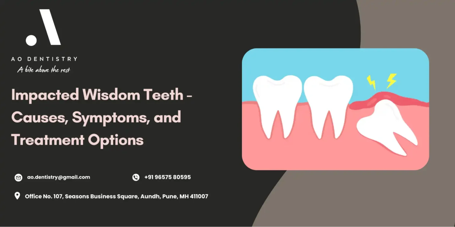 impacted wisdom teeth