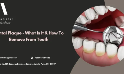 How to Remove Plaque from Teeth