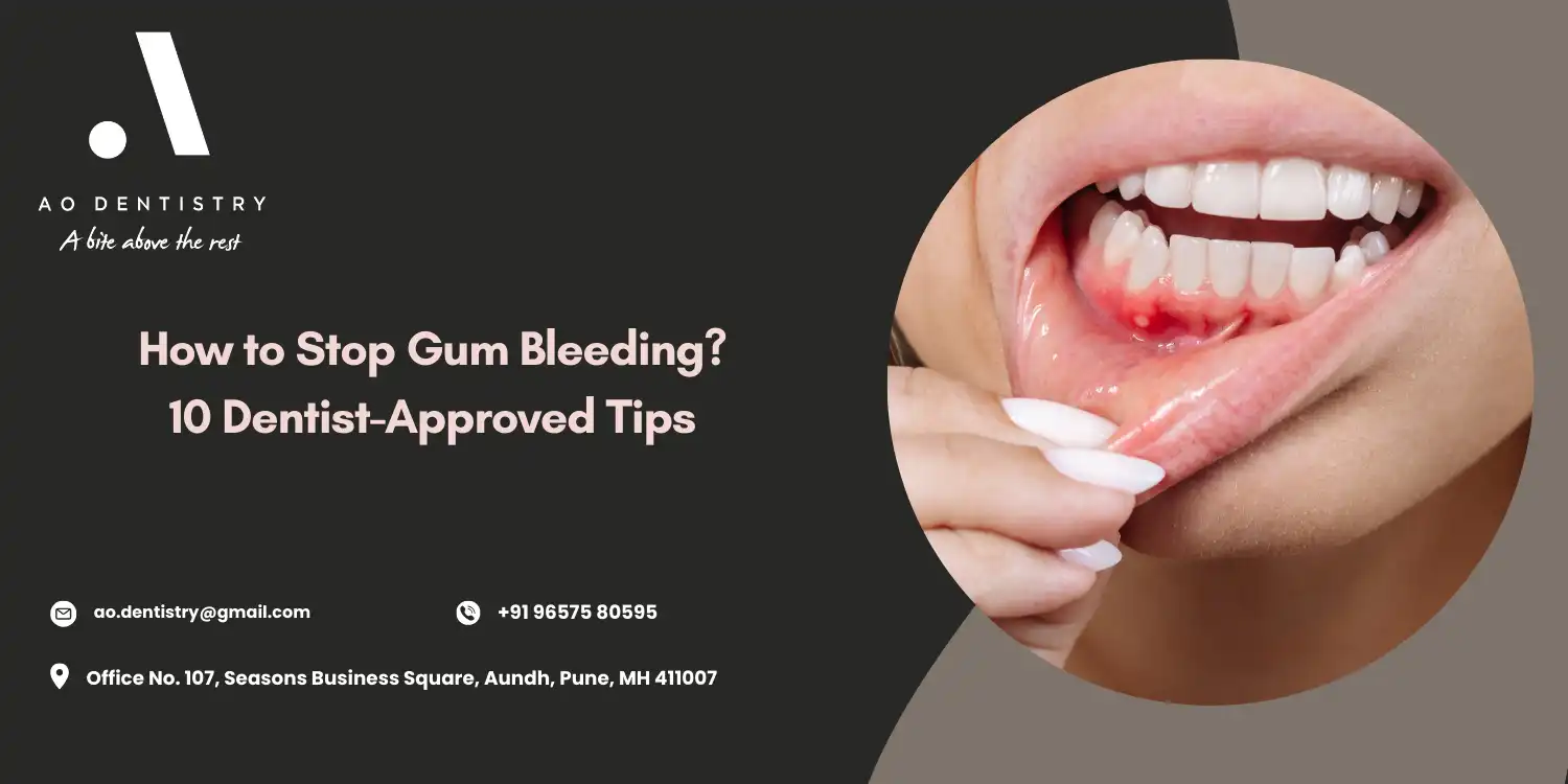 How to Stop Bleeding Gums