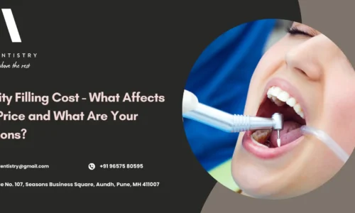 Cavity Filling Cost​