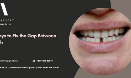 How to Fix Spaced Teeth
