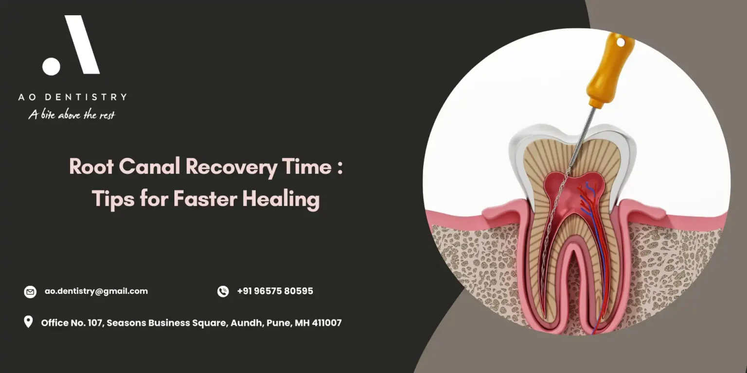 Root Canal Recovery Time