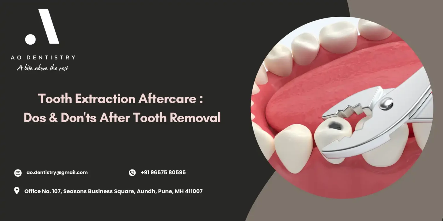 Tooth Extraction Aftercare