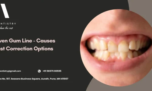 Uneven Gum Line