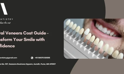 Veneers Cost
