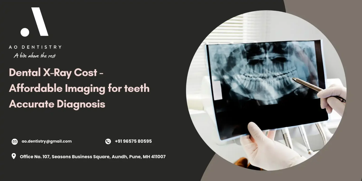Dental X Ray Cost