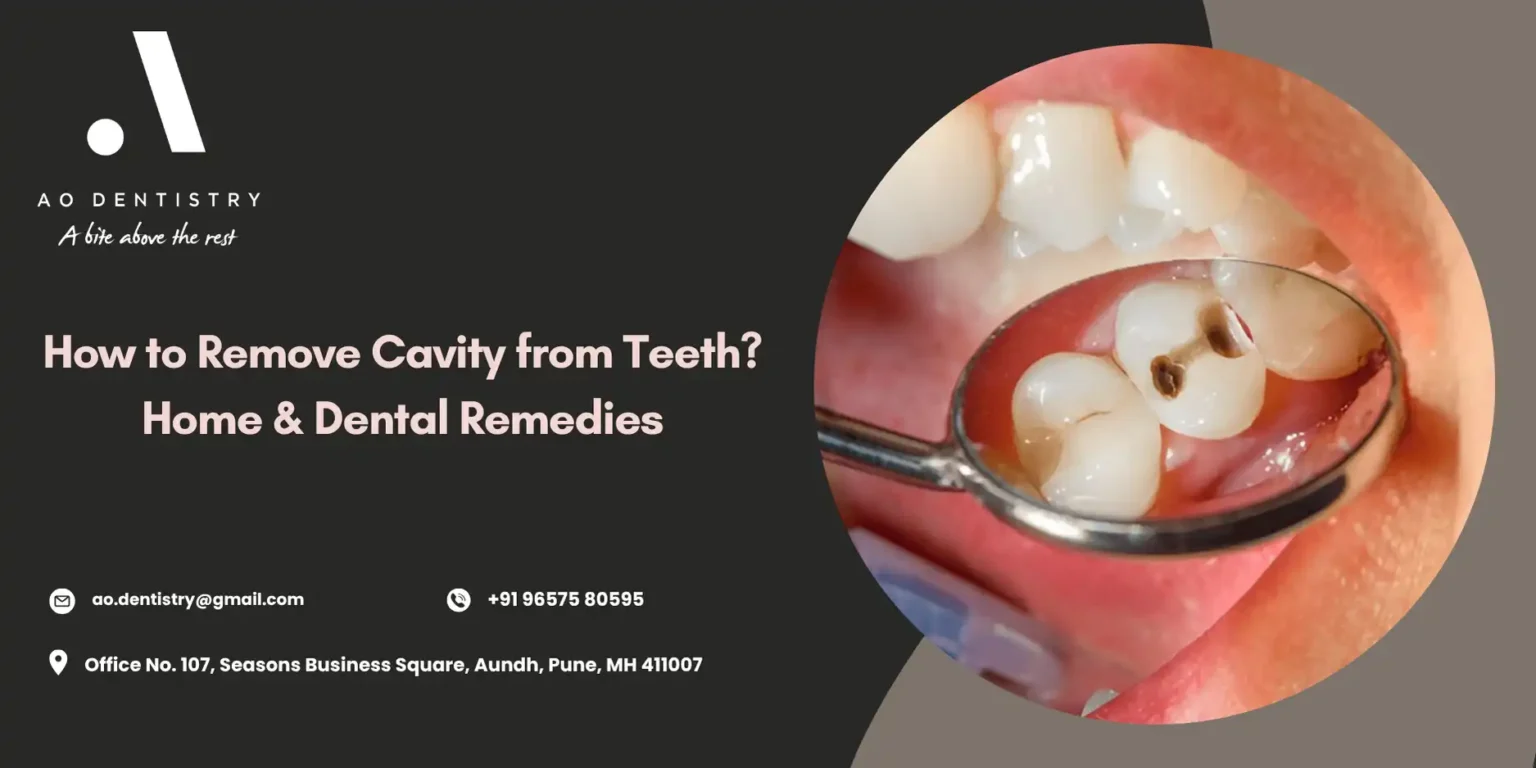How to Remove Cavity from Teeth