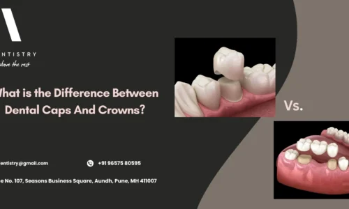 Dental Cap vs Crown