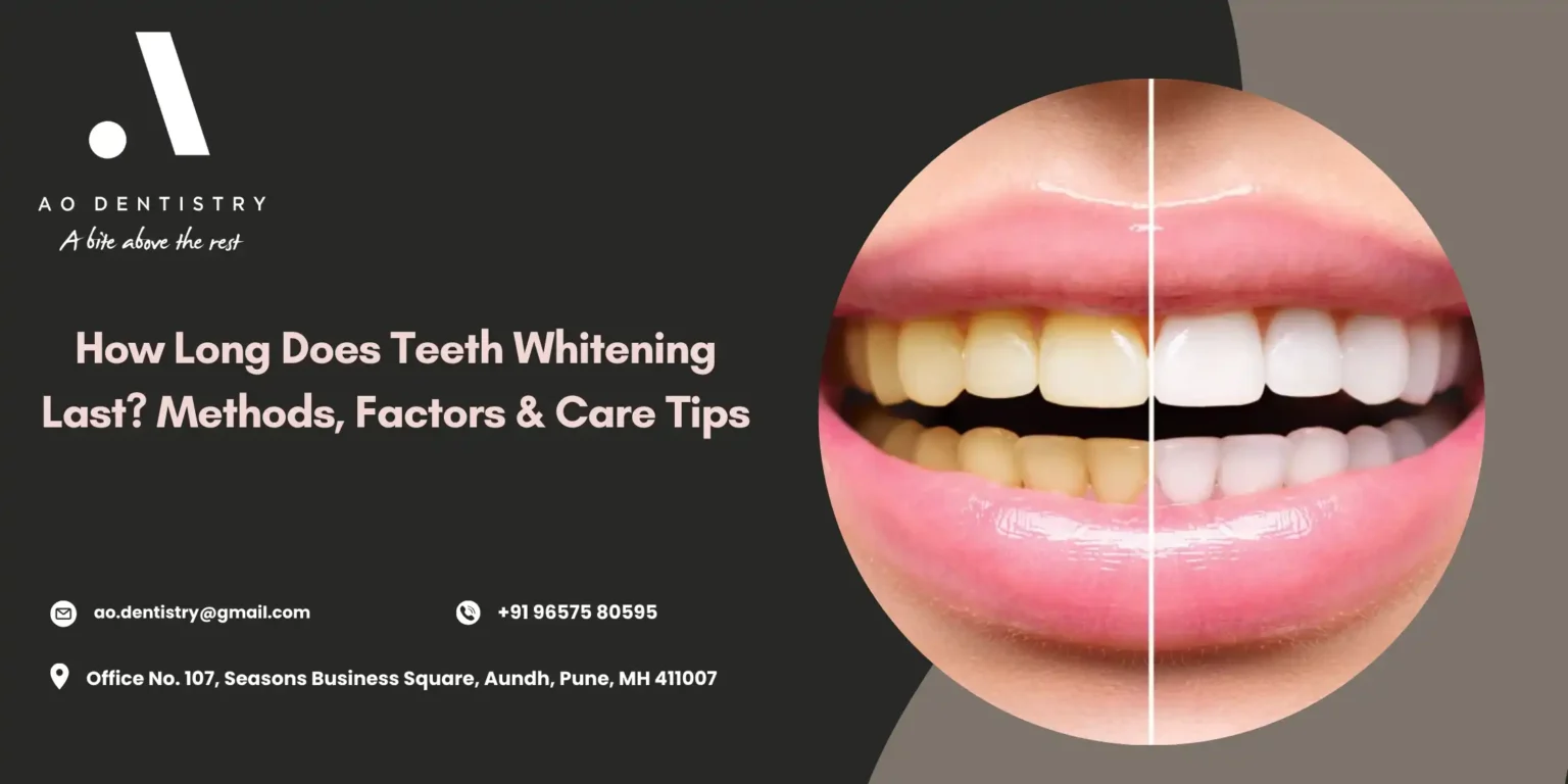 How Long Teeth Whitening Lasts