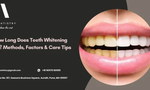 How Long Teeth Whitening Lasts