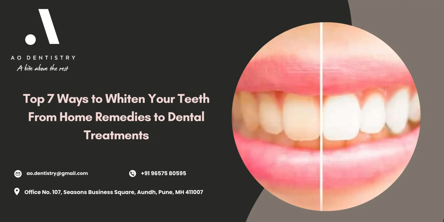How to Whiten Teeth