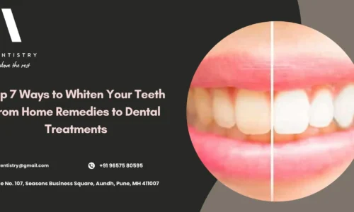 How to Whiten Teeth