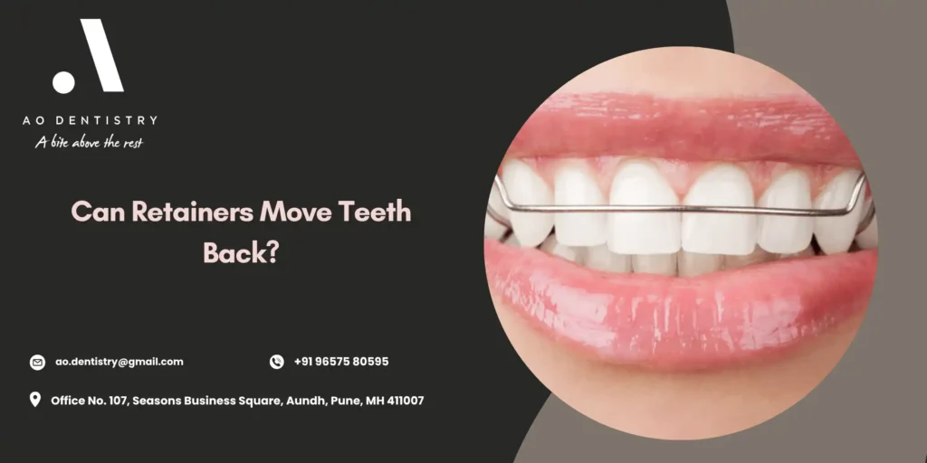 Can Retainers Move Teeth Back