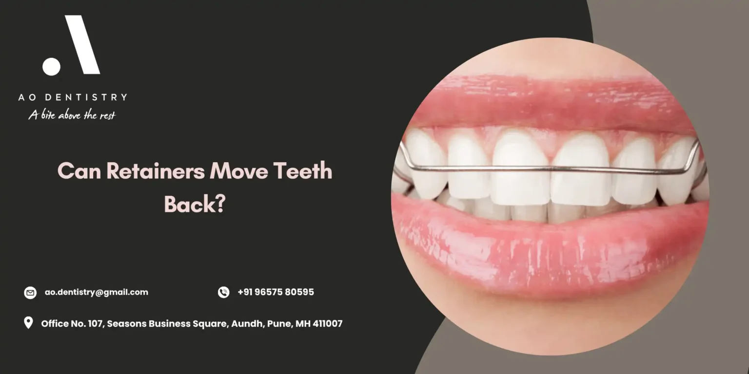 Can Retainers Move Teeth Back