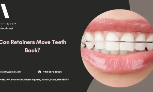 Can Retainers Move Teeth Back