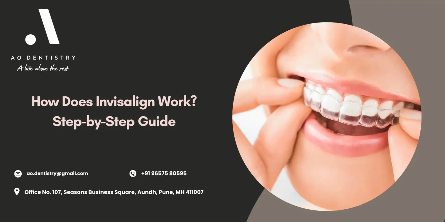 How Invisalign Works