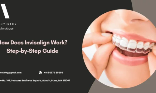 How Invisalign Works