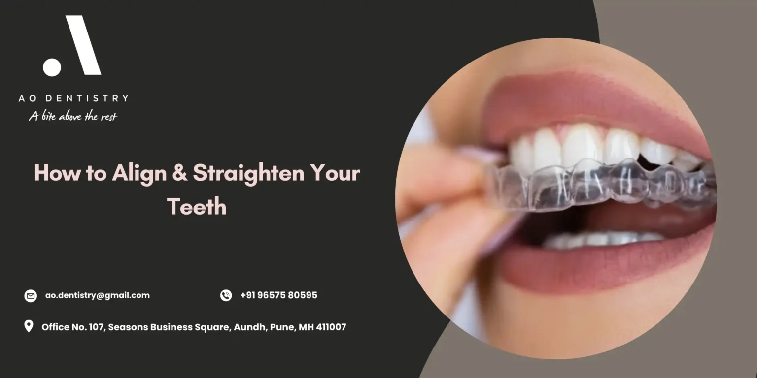 How to Align Teeth