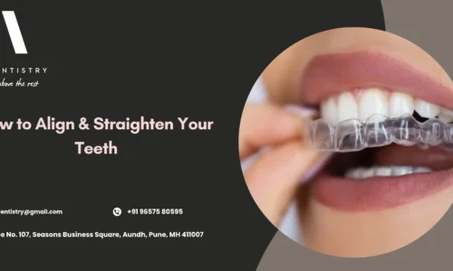 How to Align Teeth