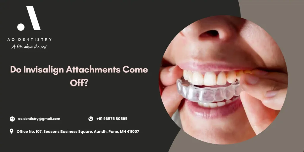 Invisalign attachments on teeth close-up