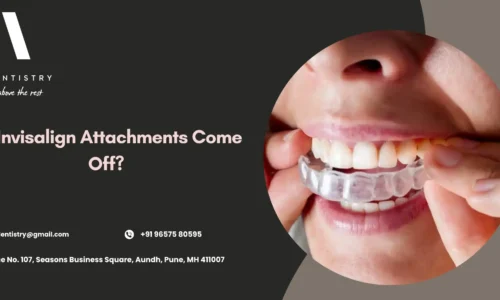 Invisalign attachments on teeth close-up