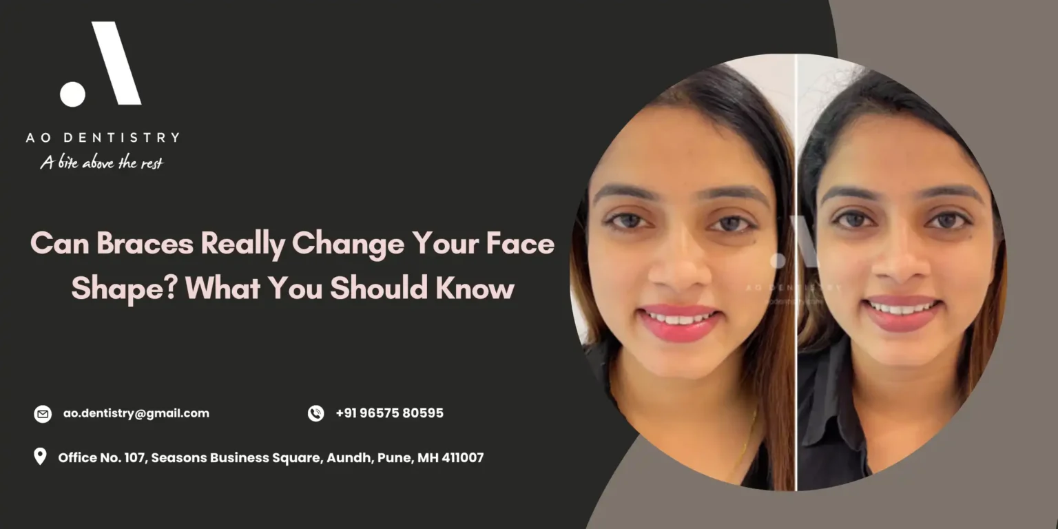 Braces before and after face shape results