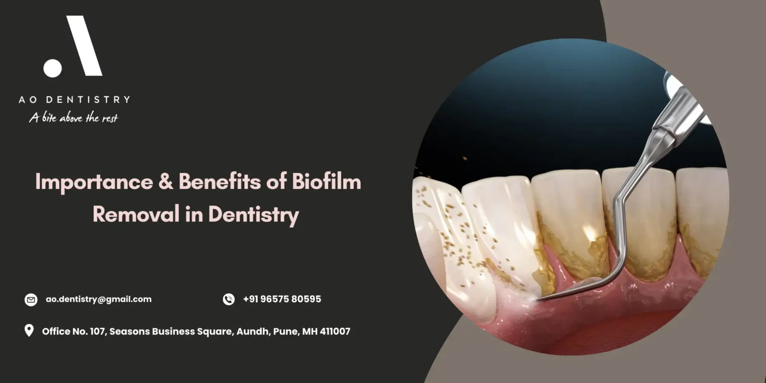 Dental biofilm removal cleaning results