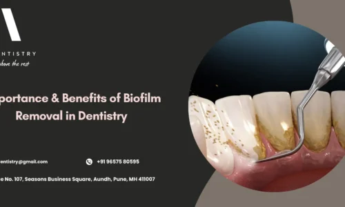 Dental biofilm removal cleaning results