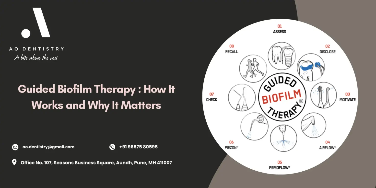 Guided biofilm therapy dental cleaning process