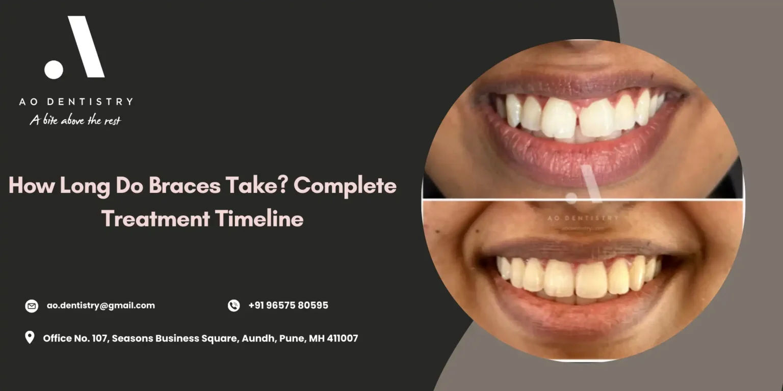 How Long Do Braces Take | Treatment Duration & Timeline AO Dentistry