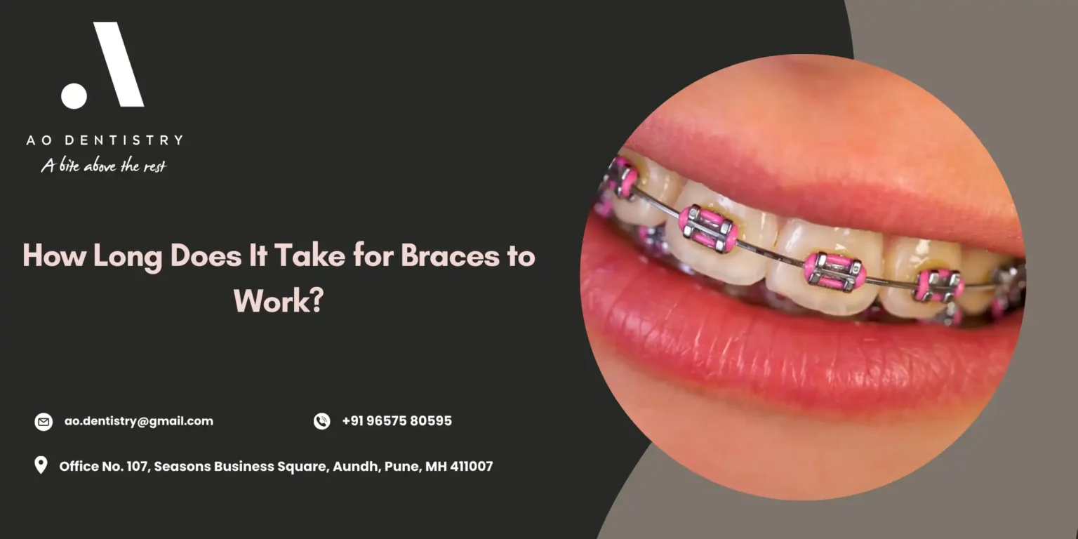 How Long Do Braces Take to Work? Timeline & Tips | AO Dentistry