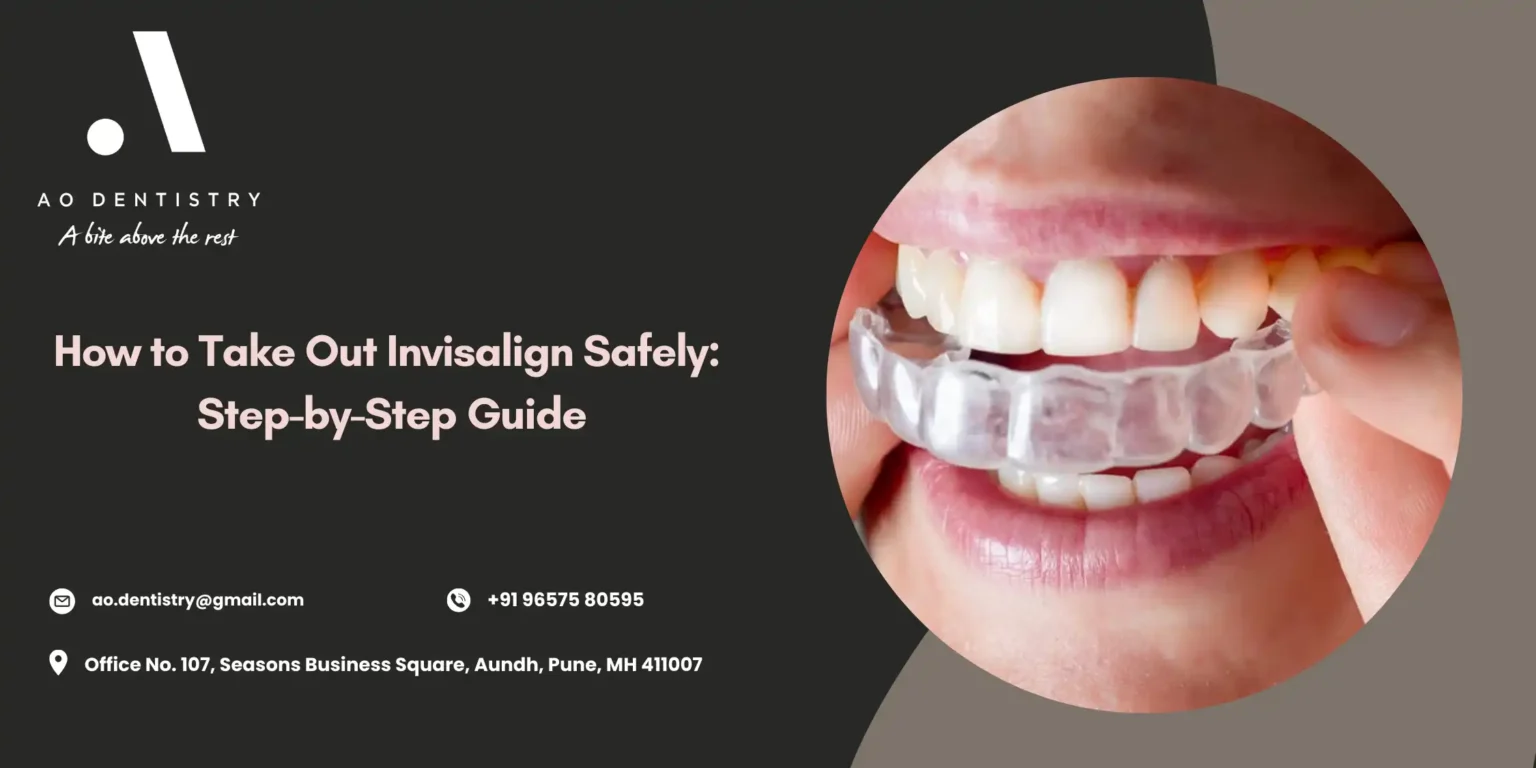 Step-by-step guide to removing Invisalign aligners